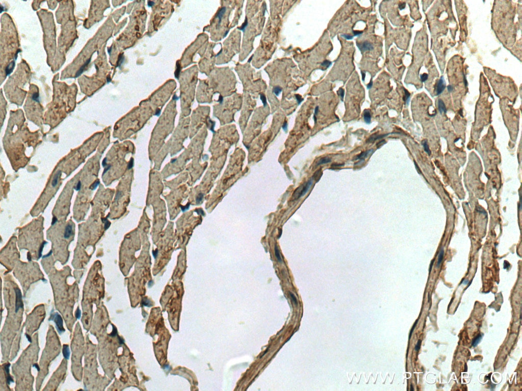 Immunohistochemistry (IHC) staining of mouse heart tissue using ACVR1 Monoclonal antibody (67417-1-Ig)