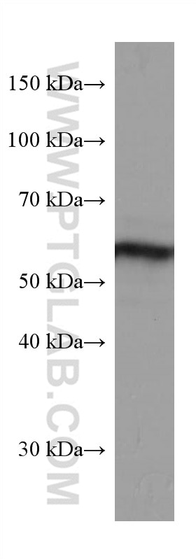 Western Blot (WB) analysis of rat brain tissue using ACVR1 Monoclonal antibody (67417-1-Ig)