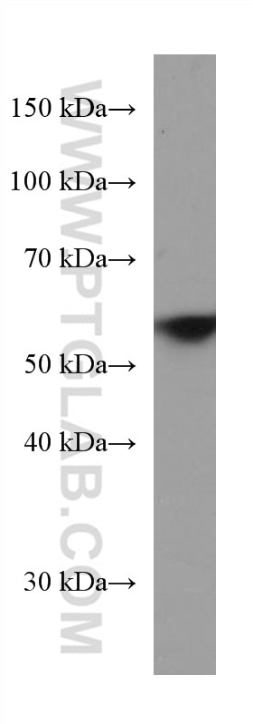 Western Blot (WB) analysis of pig brain tissue using ACVR1 Monoclonal antibody (67417-1-Ig)