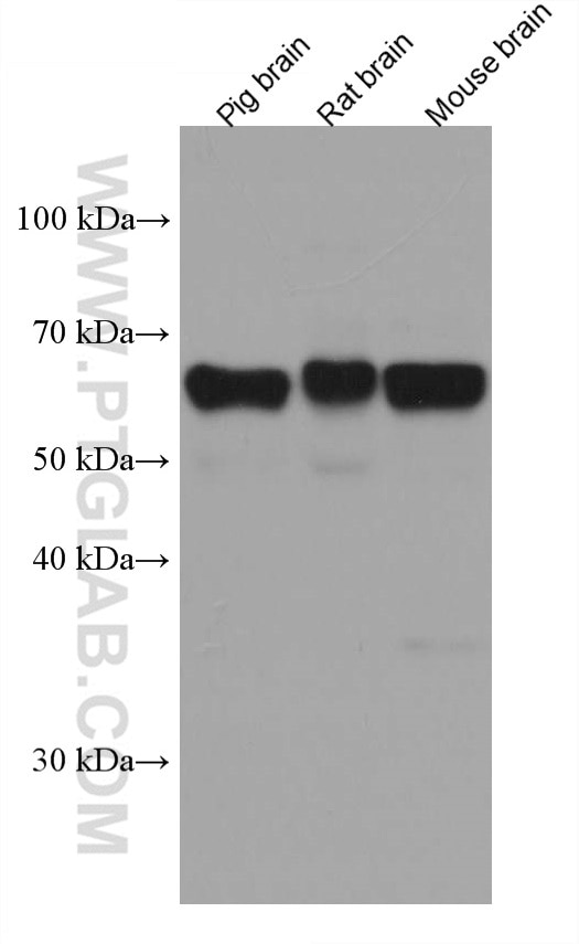 Western Blot (WB) analysis of various lysates using ACVR1 Monoclonal antibody (67417-1-Ig)