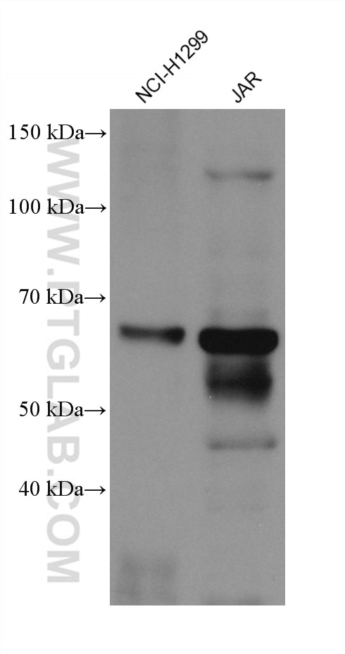 Western Blot (WB) analysis of various lysates using ACVR1 Monoclonal antibody (67417-1-Ig)
