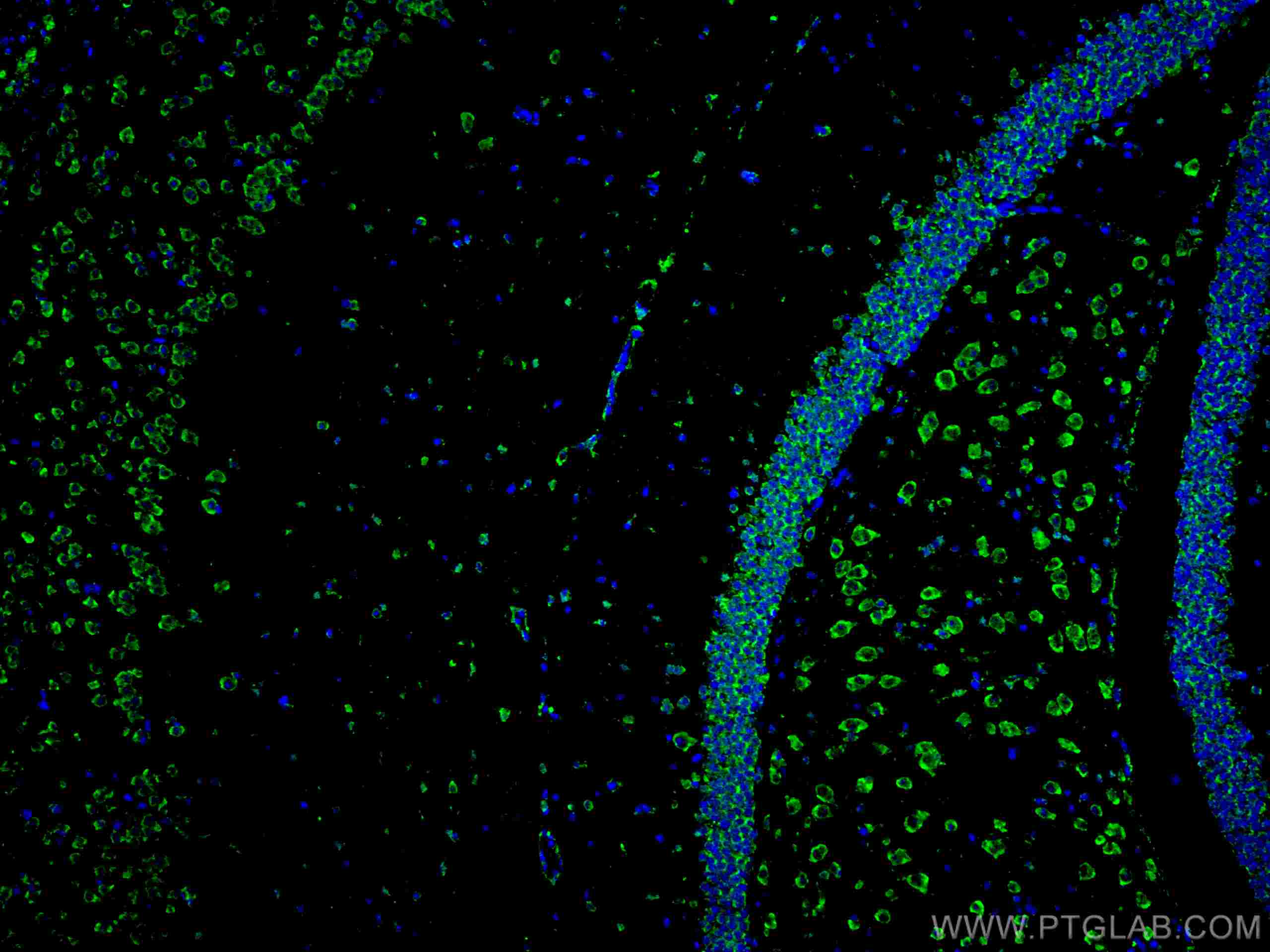 Immunofluorescence (IF) / fluorescent staining of mouse brain tissue using CoraLite® Plus 488-conjugated ACVR1 Monoclonal ant (CL488-67417)