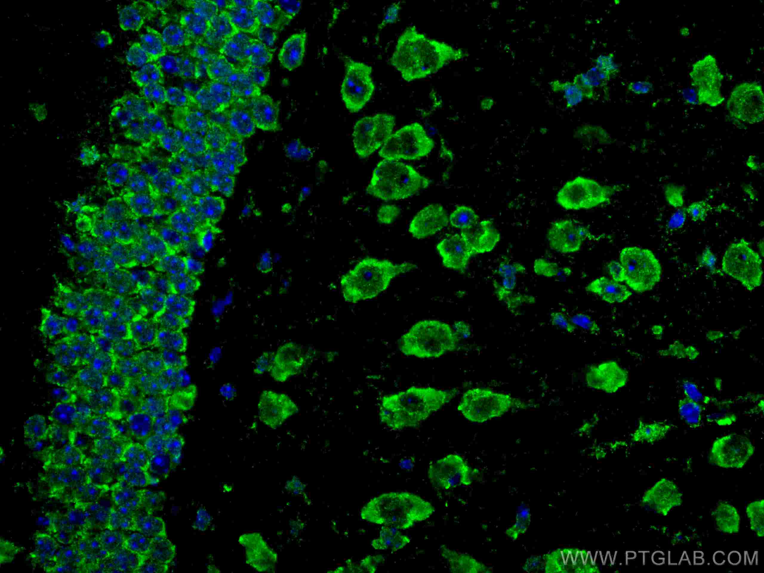 Immunofluorescence (IF) / fluorescent staining of mouse brain tissue using CoraLite® Plus 488-conjugated ACVR1 Monoclonal ant (CL488-67417)