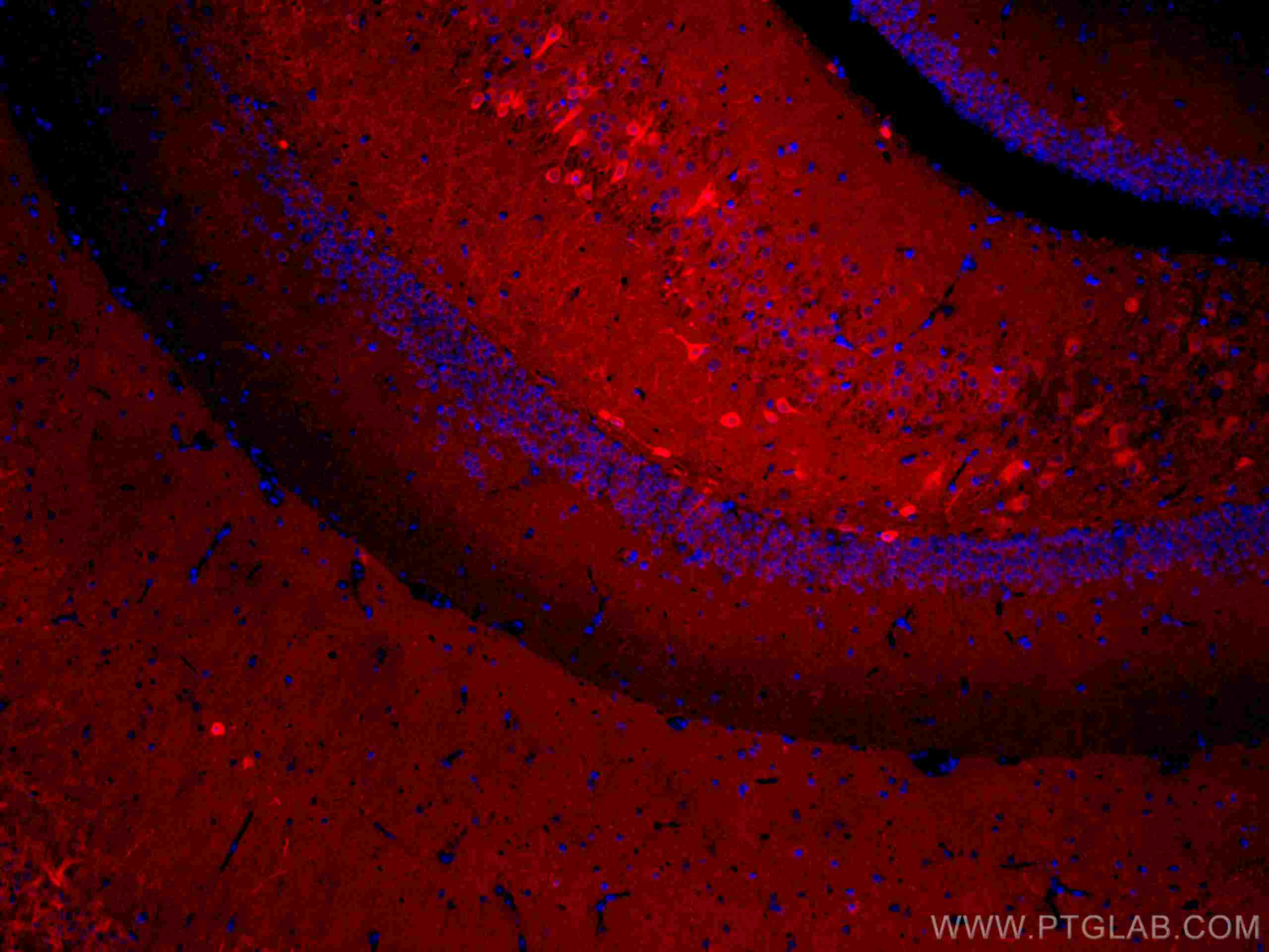 Immunofluorescence (IF) / fluorescent staining of mouse brain tissue using CoraLite®594-conjugated ACVR1 Monoclonal antibody (CL594-67417)