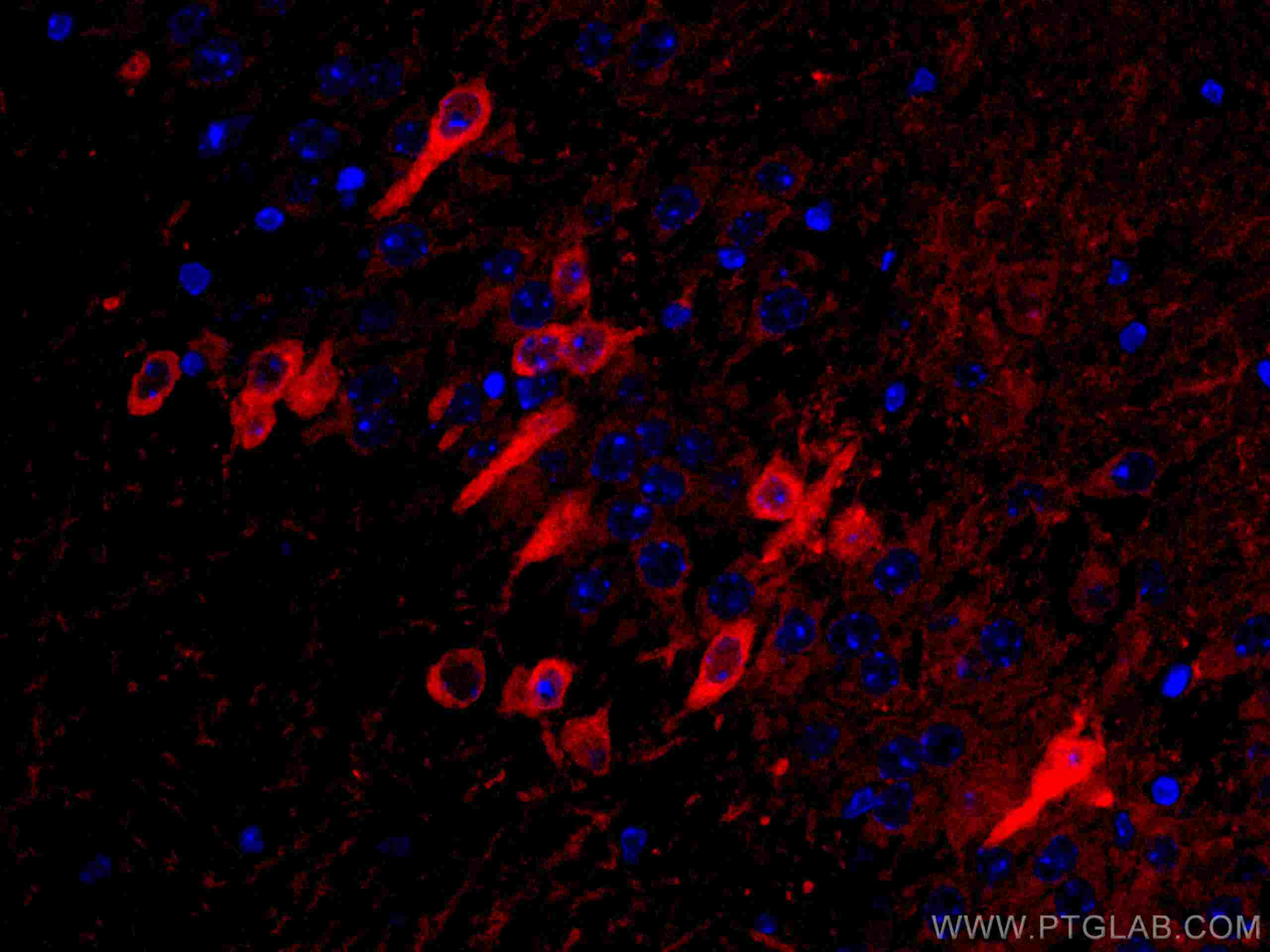 Immunofluorescence (IF) / fluorescent staining of mouse brain tissue using CoraLite®594-conjugated ACVR1 Monoclonal antibody (CL594-67417)