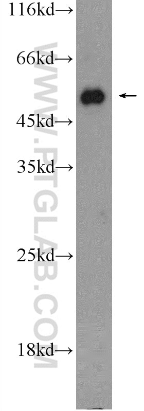 Western Blot (WB) analysis of HEK-293 cells using ACVR1B Polyclonal antibody (10086-1-AP)