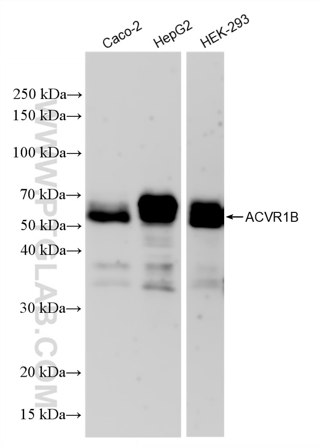 Western Blot (WB) analysis of various lysates using ACVR1B Recombinant antibody (83026-6-RR)