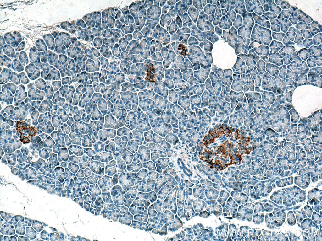 Immunohistochemistry (IHC) staining of human pancreas tissue using ACVR1C Polyclonal antibody (12610-1-AP)