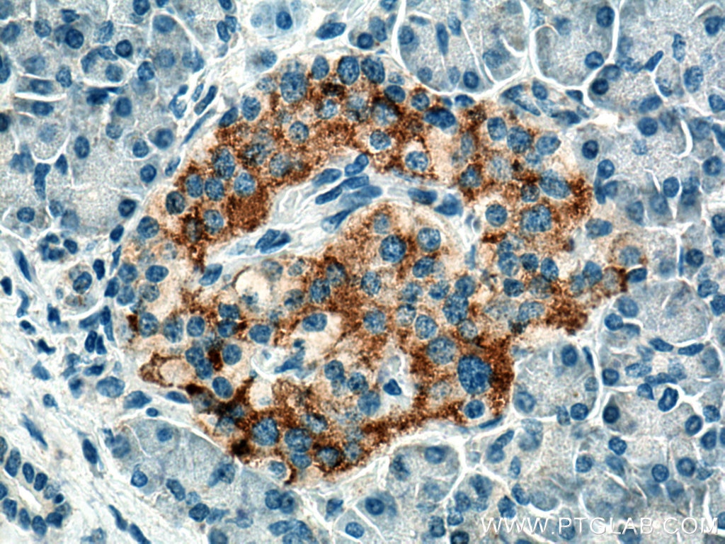 Immunohistochemistry (IHC) staining of human pancreas tissue using ACVR1C Polyclonal antibody (12610-1-AP)