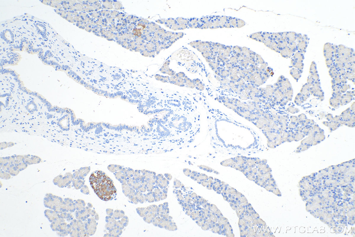 Immunohistochemistry (IHC) staining of rat pancreas tissue using ACVR1C Polyclonal antibody (12610-1-AP)