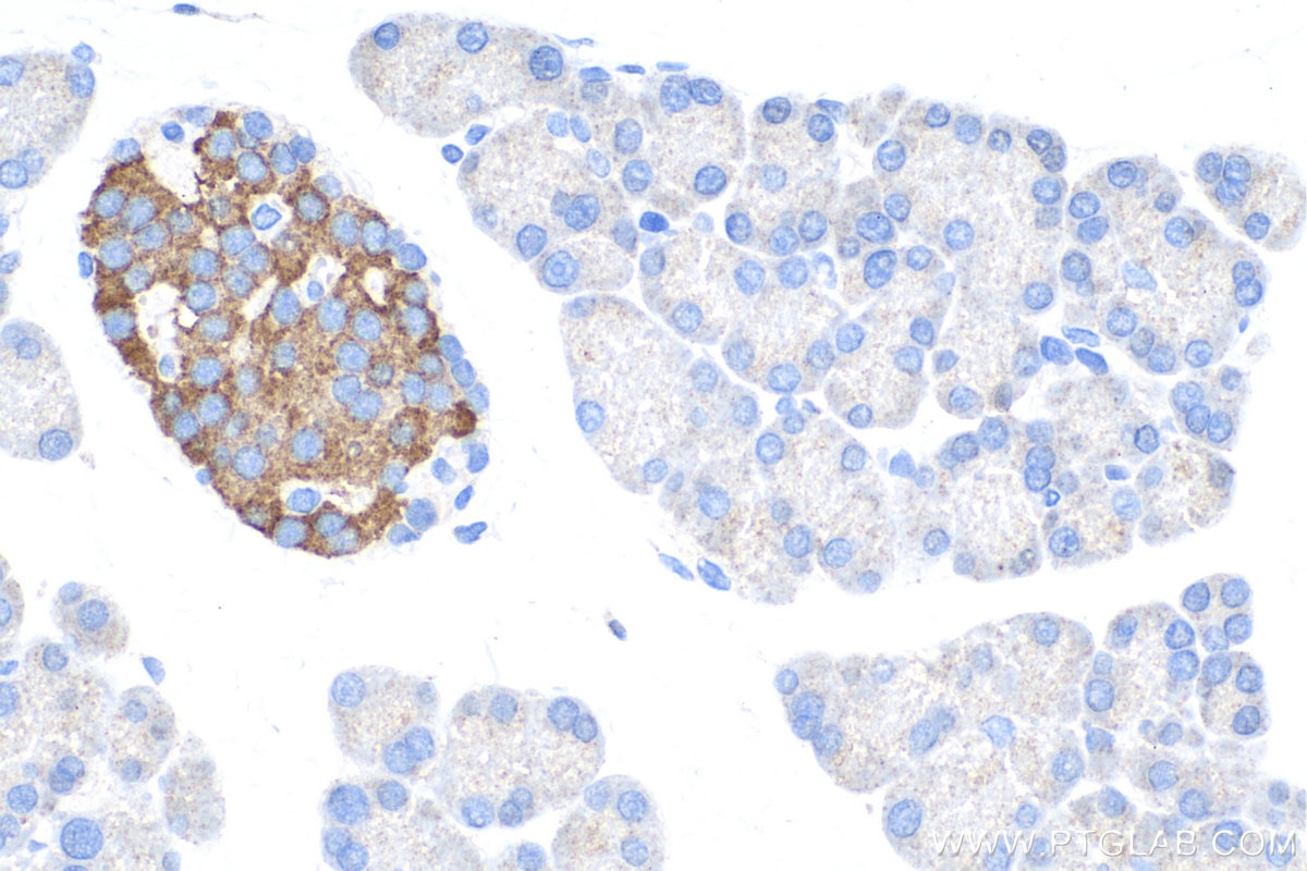 Immunohistochemistry (IHC) staining of rat pancreas tissue using ACVR1C Polyclonal antibody (12610-1-AP)