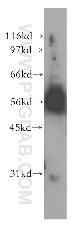 WB analysis of human kidney using 12610-1-AP