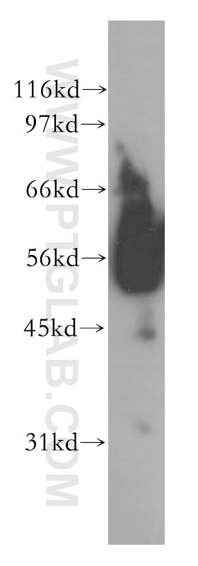 Western Blot (WB) analysis of human brain tissue using ACVR1C Polyclonal antibody (12610-1-AP)