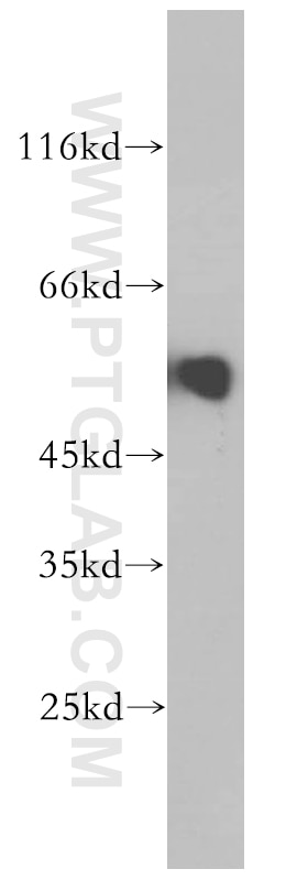 Western Blot (WB) analysis of human skeletal muscle tissue using ACVR1C Polyclonal antibody (12610-1-AP)