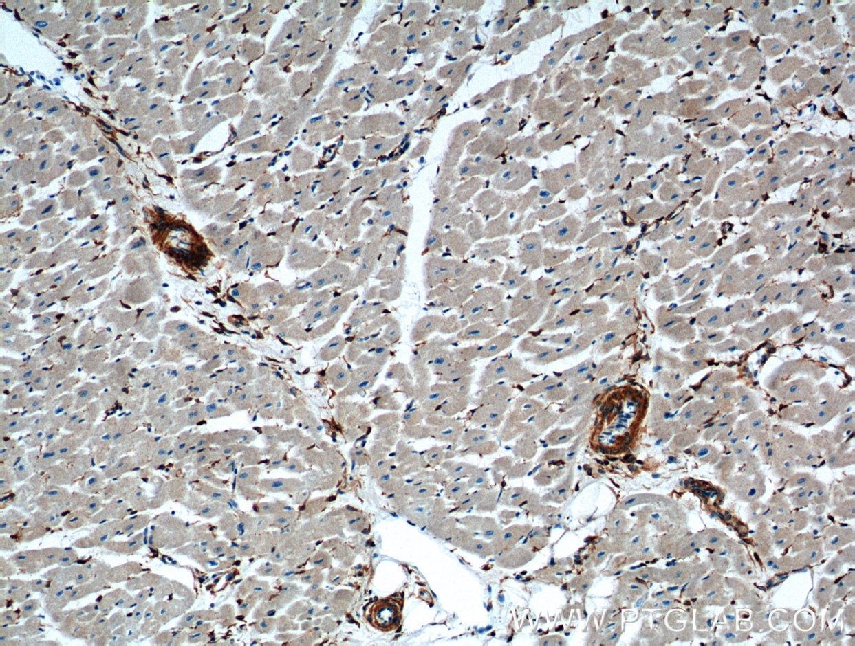 Immunohistochemistry (IHC) staining of human heart tissue using ACVRL1 Polyclonal antibody (14745-1-AP)