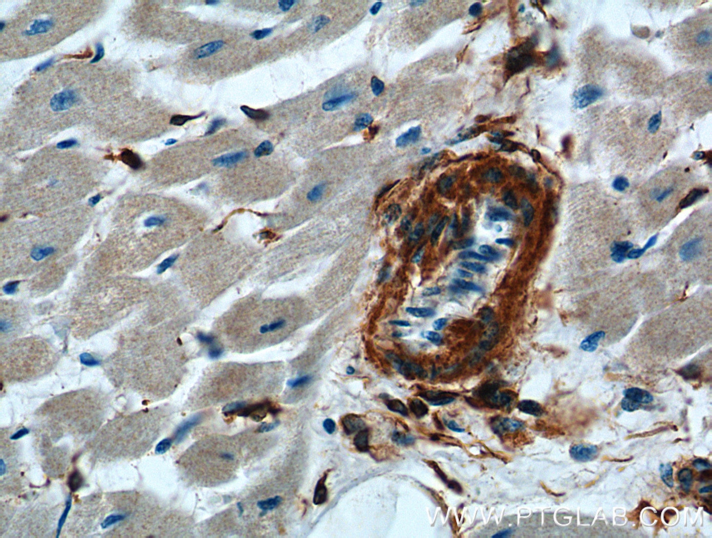 Immunohistochemistry (IHC) staining of human heart tissue using ACVRL1 Polyclonal antibody (14745-1-AP)