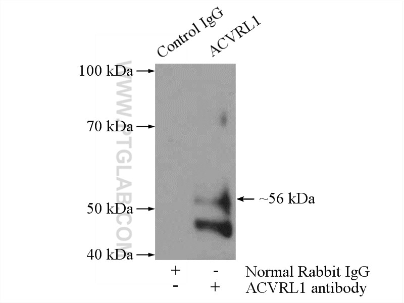 Immunoprecipitation (IP) experiment of Jurkat cells using ACVRL1 Polyclonal antibody (14745-1-AP)
