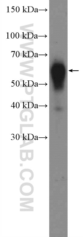 Western Blot (WB) analysis of human placenta tissue using ACVRL1 Polyclonal antibody (14745-1-AP)