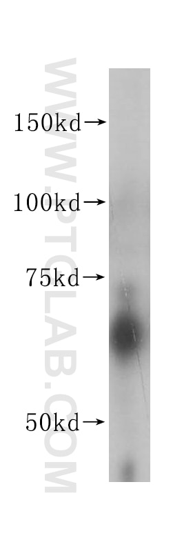 Western Blot (WB) analysis of human placenta tissue using ACVRL1 Polyclonal antibody (14745-1-AP)