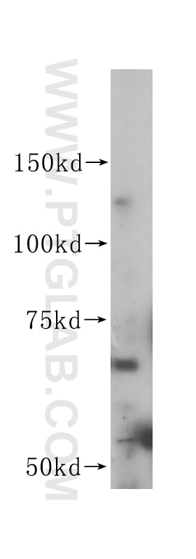 ACVRL1 Polyclonal antibody