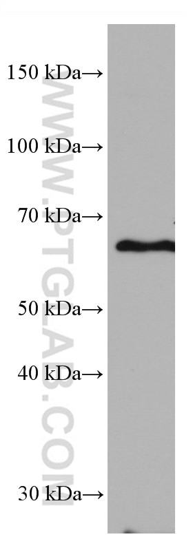 Western Blot (WB) analysis of Daudi cells using ACVRL1 Monoclonal antibody (66857-1-Ig)