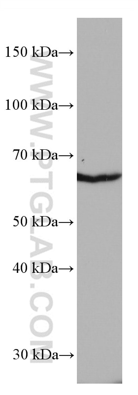Western Blot (WB) analysis of Jurkat cells using ACVRL1 Monoclonal antibody (66857-1-Ig)