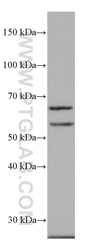 Western Blot (WB) analysis of HUVEC cells using ACVRL1 Monoclonal antibody (66857-1-Ig)