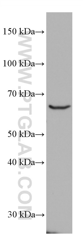 Western Blot (WB) analysis of JAR cells using ACVRL1 Monoclonal antibody (66857-1-Ig)