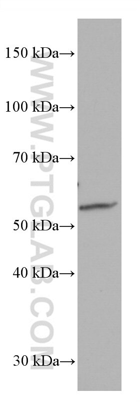 Western Blot (WB) analysis of human placenta tissue using ACVRL1 Monoclonal antibody (66857-1-Ig)