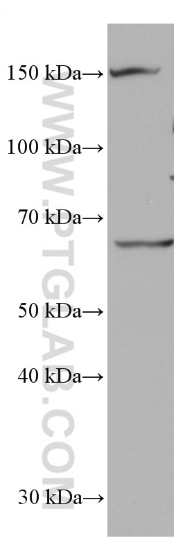 Western Blot (WB) analysis of mouse brain tissue using ACVRL1 Monoclonal antibody (66857-1-Ig)