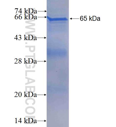 ACVRL1 fusion protein Ag6449 SDS-PAGE