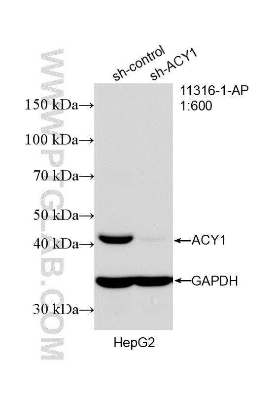 Western Blot (WB) analysis of HepG2 cells using ACY1 Polyclonal antibody (11316-1-AP)