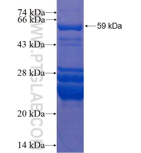 ACY1 fusion protein Ag1813 SDS-PAGE