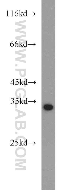 Western Blot (WB) analysis of mouse liver tissue using ACY3 Polyclonal antibody (16786-1-AP)