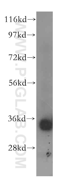 Western Blot (WB) analysis of mouse liver tissue using ACY3 Polyclonal antibody (16786-1-AP)