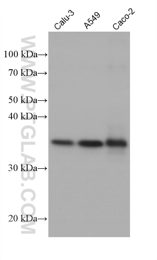 WB analysis using 68711-1-Ig