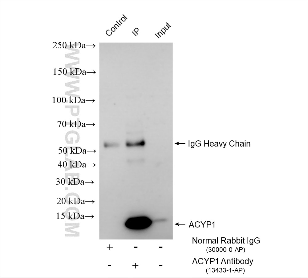 Immunoprecipitation (IP) experiment of HEK-293 cells using ACYP1 Polyclonal antibody (13433-1-AP)