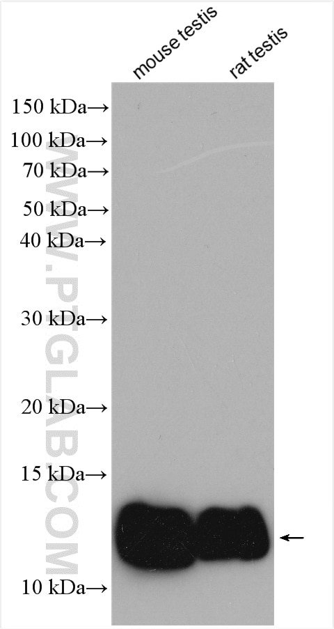 Western Blot (WB) analysis of various lysates using ACYP1 Polyclonal antibody (13433-1-AP)