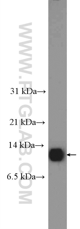 Western Blot (WB) analysis of rat testis tissue using ACYP1 Polyclonal antibody (13433-1-AP)
