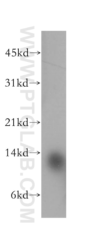 Western Blot (WB) analysis of human brain tissue using ACYP1 Polyclonal antibody (13433-1-AP)