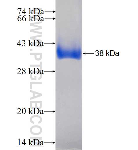 ACYP1 fusion protein Ag4237 SDS-PAGE