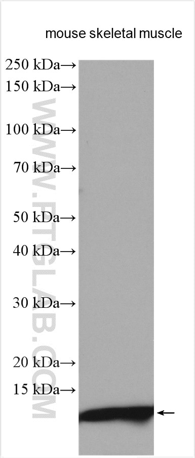 Western Blot (WB) analysis of various lysates using ACYP2 Polyclonal antibody (12302-1-AP)