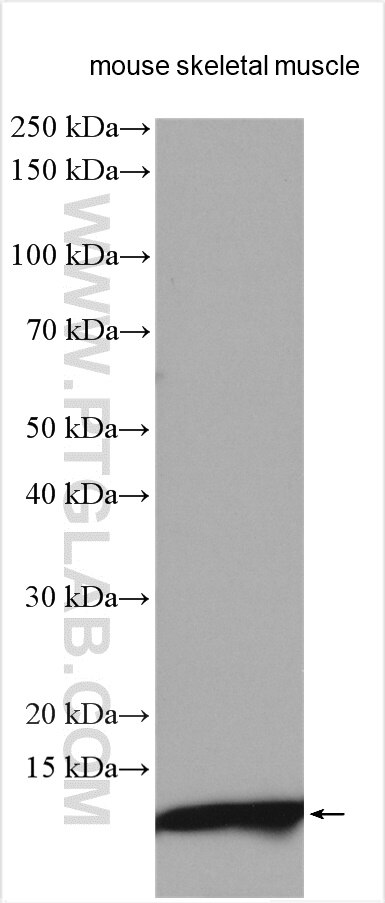 Western Blot (WB) analysis of various lysates using ACYP2 Polyclonal antibody (12302-1-AP)