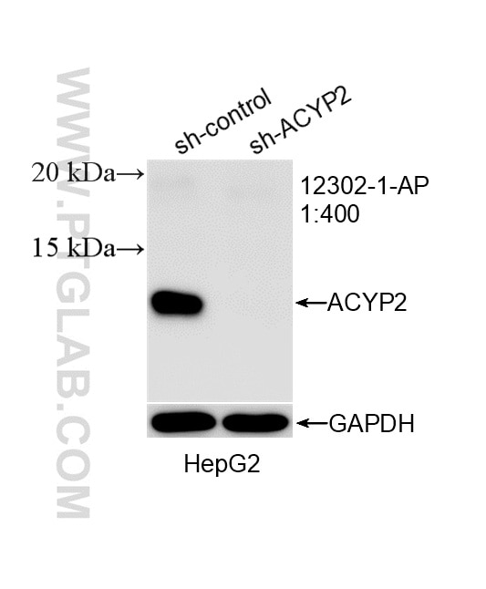 Western Blot (WB) analysis of HepG2 cells using ACYP2 Polyclonal antibody (12302-1-AP)