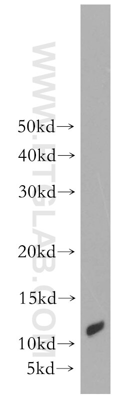 ACYP2