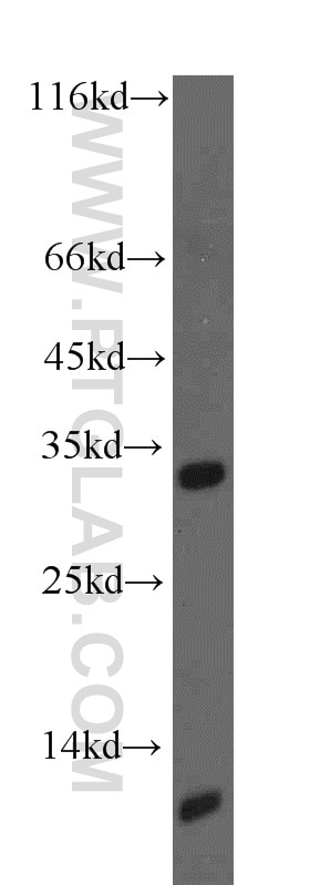 Western Blot (WB) analysis of human skeletal muscle tissue using ACYP2 Polyclonal antibody (12302-1-AP)