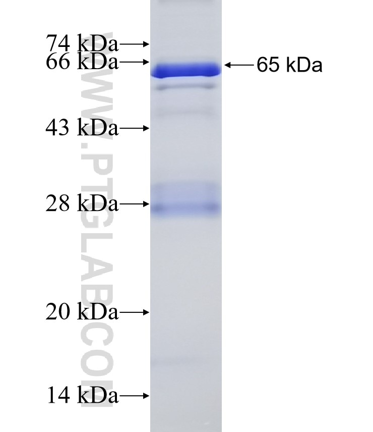 AD7c-NTP fusion protein Ag32506 SDS-PAGE AD7c-NTP fusion protein Ag32506 SDS-PAGE