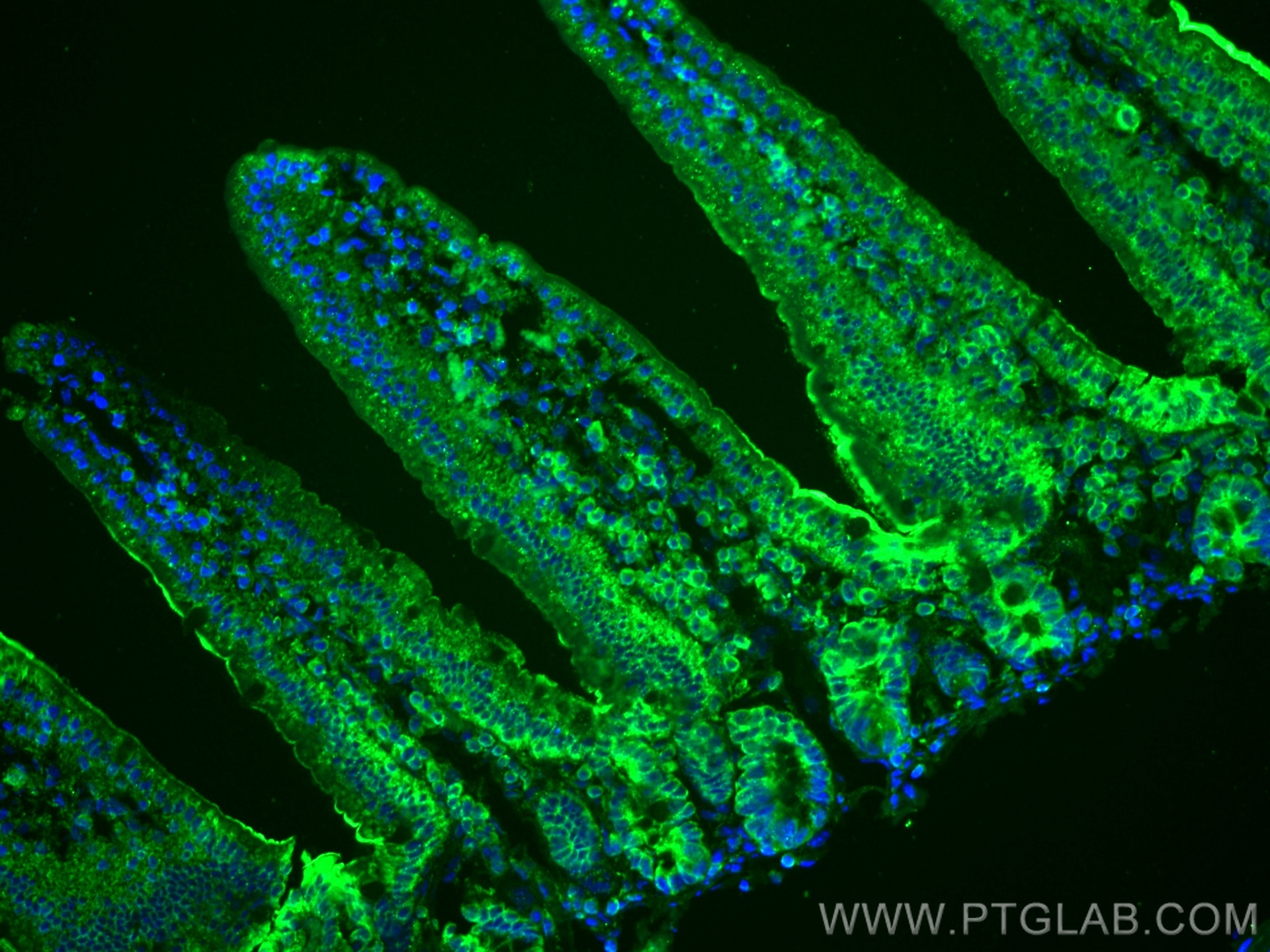 Immunofluorescence (IF) / fluorescent staining of mouse small intestine tissue using ADA Polyclonal antibody (13328-1-AP)