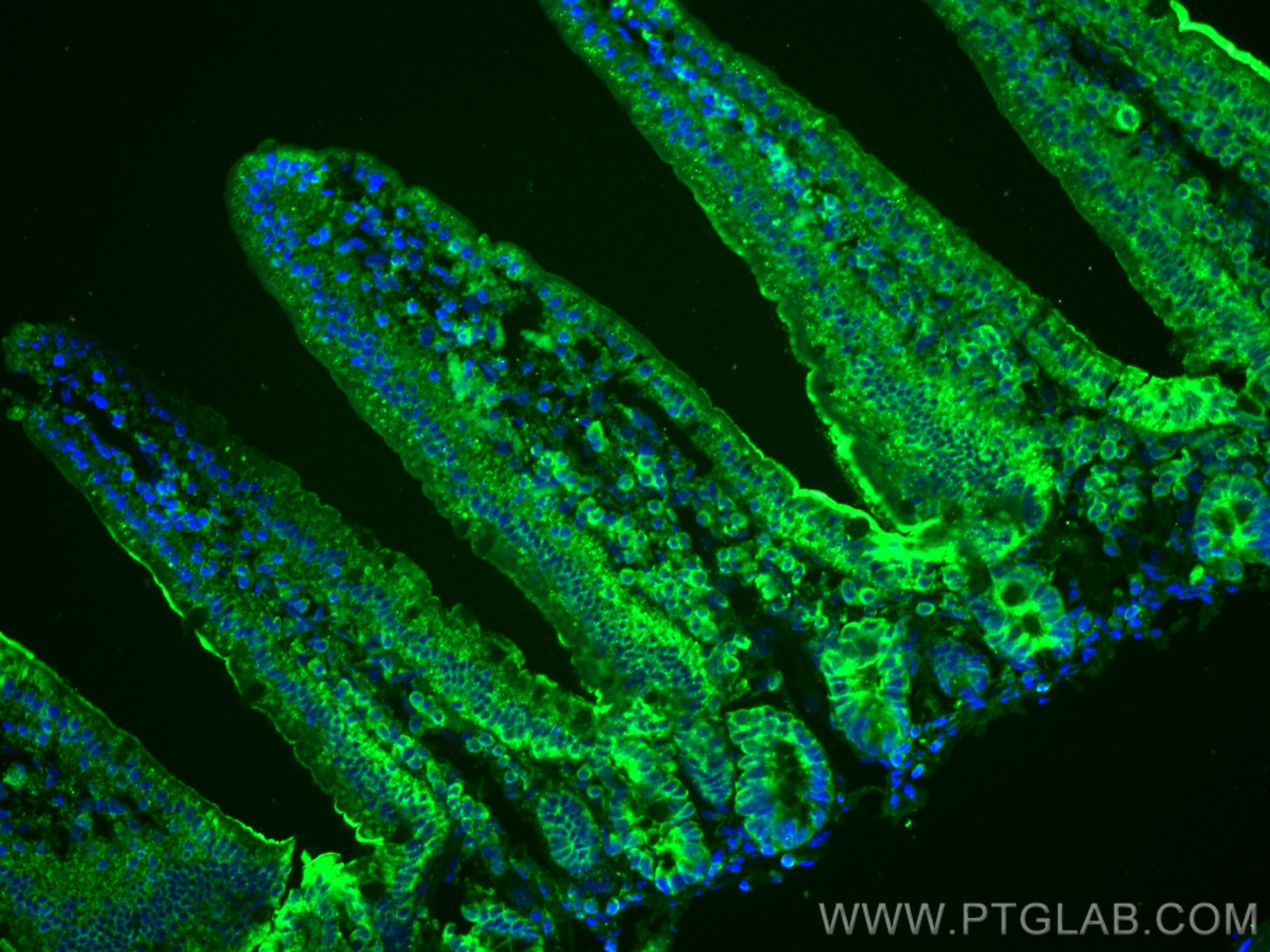 Immunofluorescence (IF) / fluorescent staining of mouse small intestine tissue using ADA Polyclonal antibody (13328-1-AP)