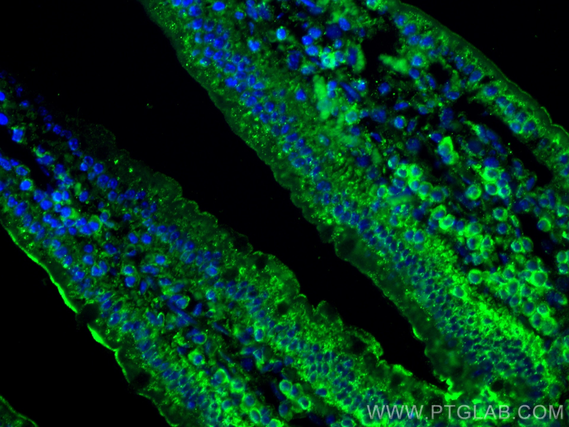 Immunofluorescence (IF) / fluorescent staining of mouse small intestine tissue using ADA Polyclonal antibody (13328-1-AP)